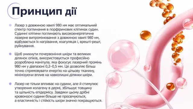 Схема проходження лазерного світла 980 нм до кровоносної судини.