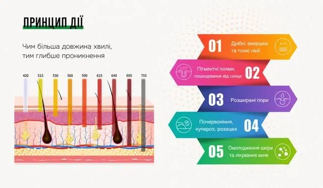 Схема проникнення світла різних довжин хвиль у шкіру.